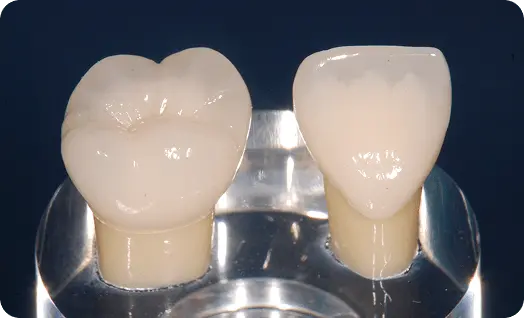 テキオールセラミッククラウンストテキスト