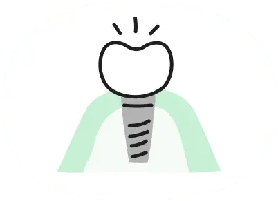 人工の歯をセット