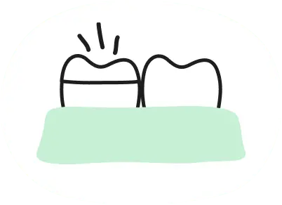 冠でかぶせます