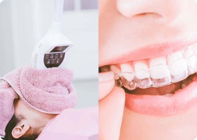 デュアルホワイトニング