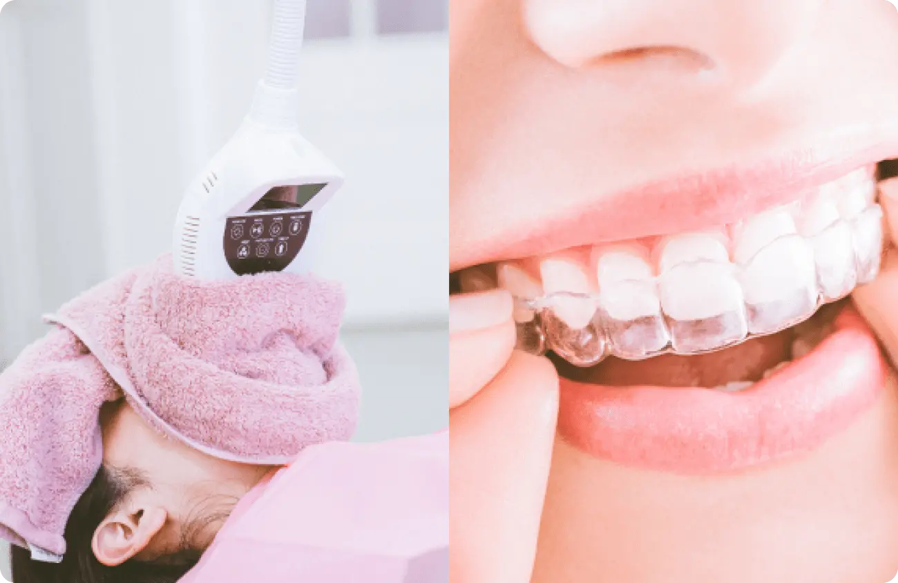 デュアルホワイトニング